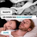 Set 3 pachete dilatator nazal anti-sforait RAZO, Respiratie imbunatatita, Reutilizabil, 45 bucati